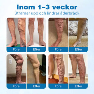 VeinGuard örtspray