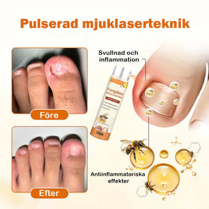 Avancerad nagelreparationsspray