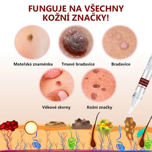 Senzor pro odstranění skvrn a skvrn koupit 1 a získat 1 zdarma (2 kusy)