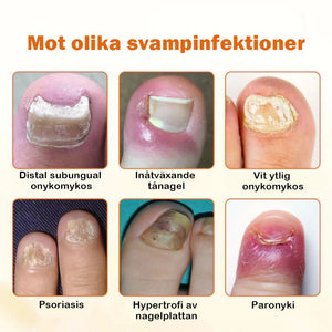 Avancerad nagelreparationsspray