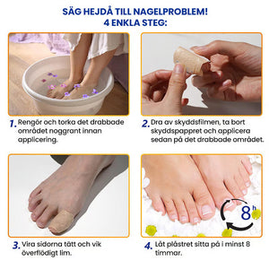 Svampnagelplåster