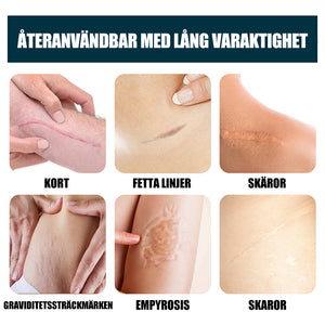 Gel för eliminering av ärr minskar mörka fläckar