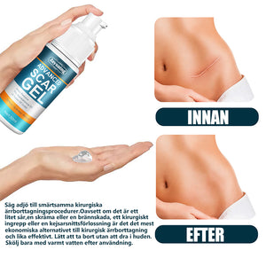 Gel för eliminering av ärr minskar mörka fläckar